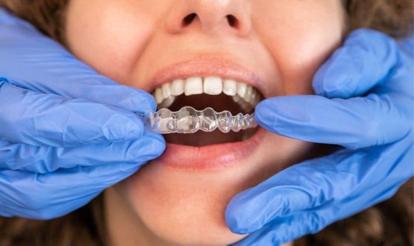 Invisalign Treatment Lafayette