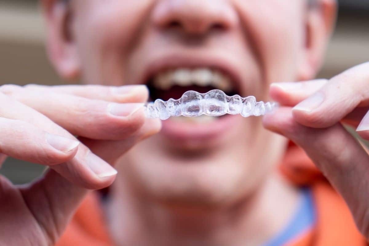 Invisalign Treatment: Do’s and Don’ts You Should Know