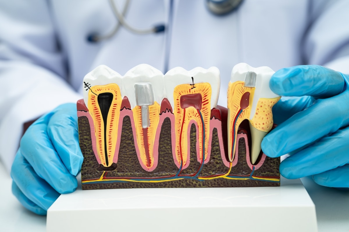 dentist in lafayette