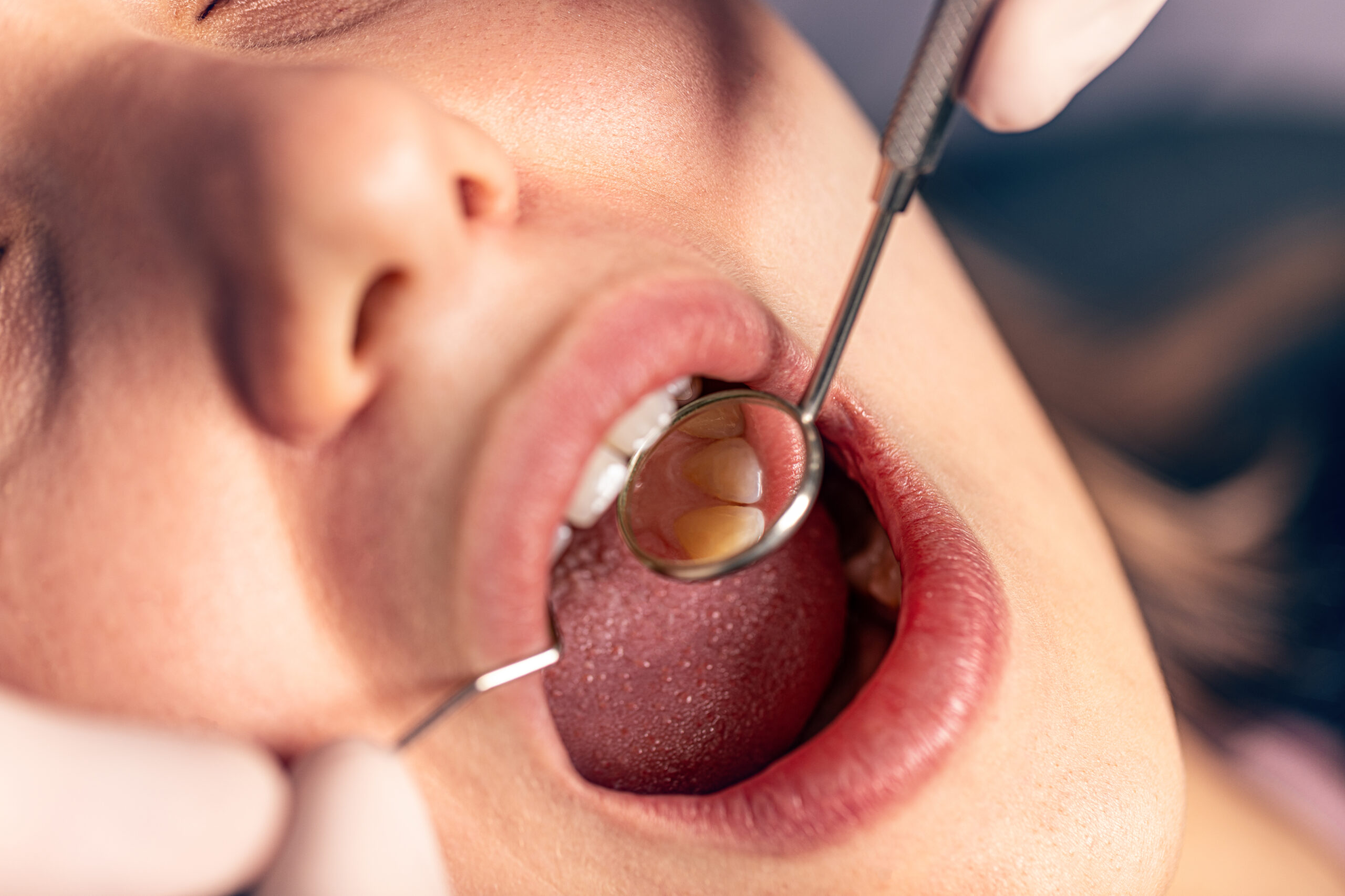 dental office lafayette